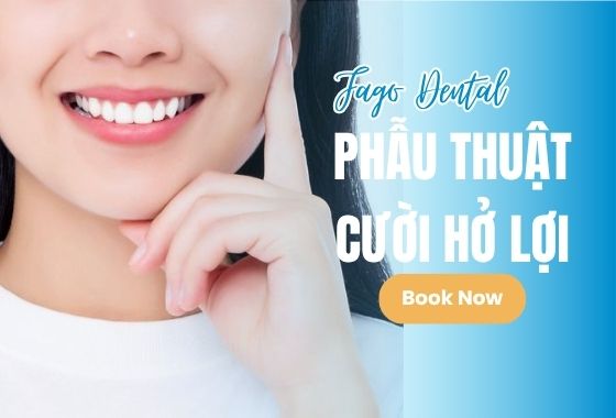 Phẫu Thuật Cười Hở Lợi
